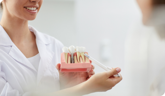 Nurse Demonstrating Dental Implants Treatment at Living Water Dentistry Dental Implants In Surrey
