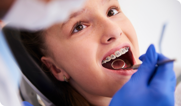 Dentist carefully examines metal braces of a young girl with a dental mirror in Surrey, BC.